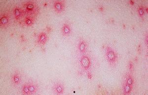 梅毒女的吃瓜,一场吃瓜群众的狂欢与反思