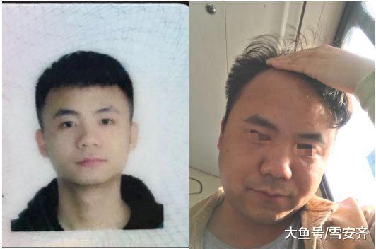 少年 熬夜吃瓜秃头