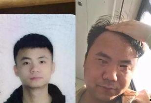 少年 熬夜吃瓜秃头